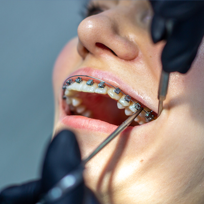 Yurt Dışından Tedavi İçin Gelmeden Önce, Dikkat Edilmesi Gereken Noktalar.